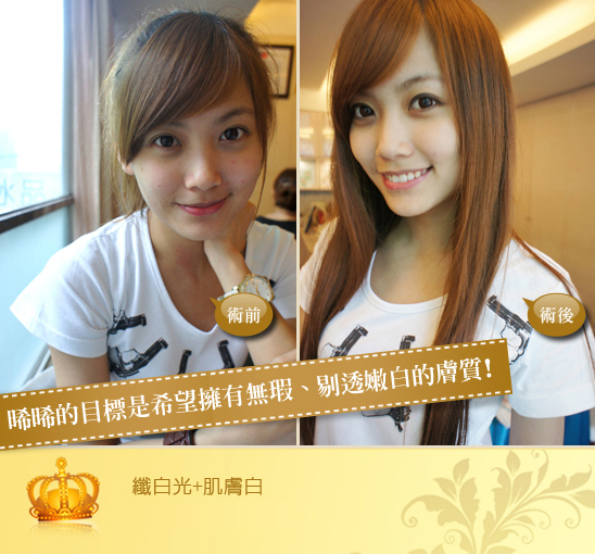 美白-粉餅雷射-德國光纖雷射-纖白光-美白淡斑-八德醫學美容-桃園醫學美容-八德桃園彤顏診所-保濕導入-美白效果好-粉餅雷射價錢