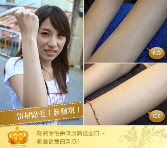 雷射除毛推薦-雷射除毛前後效果-雷射除毛價格-中壢除毛-桃園除毛-醫美除毛推薦-腋下除毛推薦-永久除毛