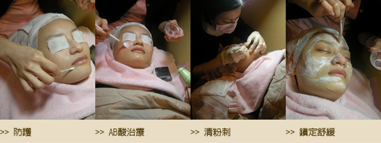 AB酸換膚-粉刺-毛孔-痘痘-出油-皮膚專科-皮膚管理專家-長痘痘怎麼辦-果酸換膚費用