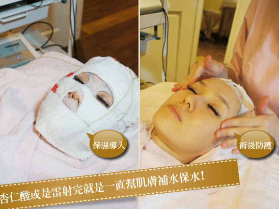 杏仁酸-杏仁酸換膚-杏仁酸效果-美白-痘疤-痘痘-杏仁酸煥膚-粉刺掰掰-消痘疤-中壢醫美-桃園醫美-八德醫美-杏仁酸價格