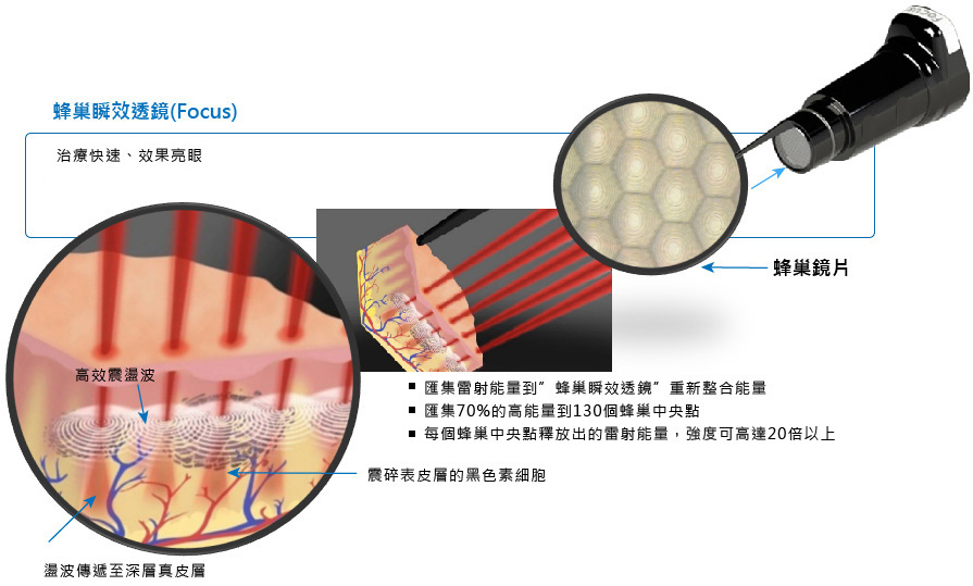 蜂巢皮秒雷射推薦-蜂巢皮秒雷射效果-皮秒除斑-皮秒痘疤-林口皮秒-桃園皮秒