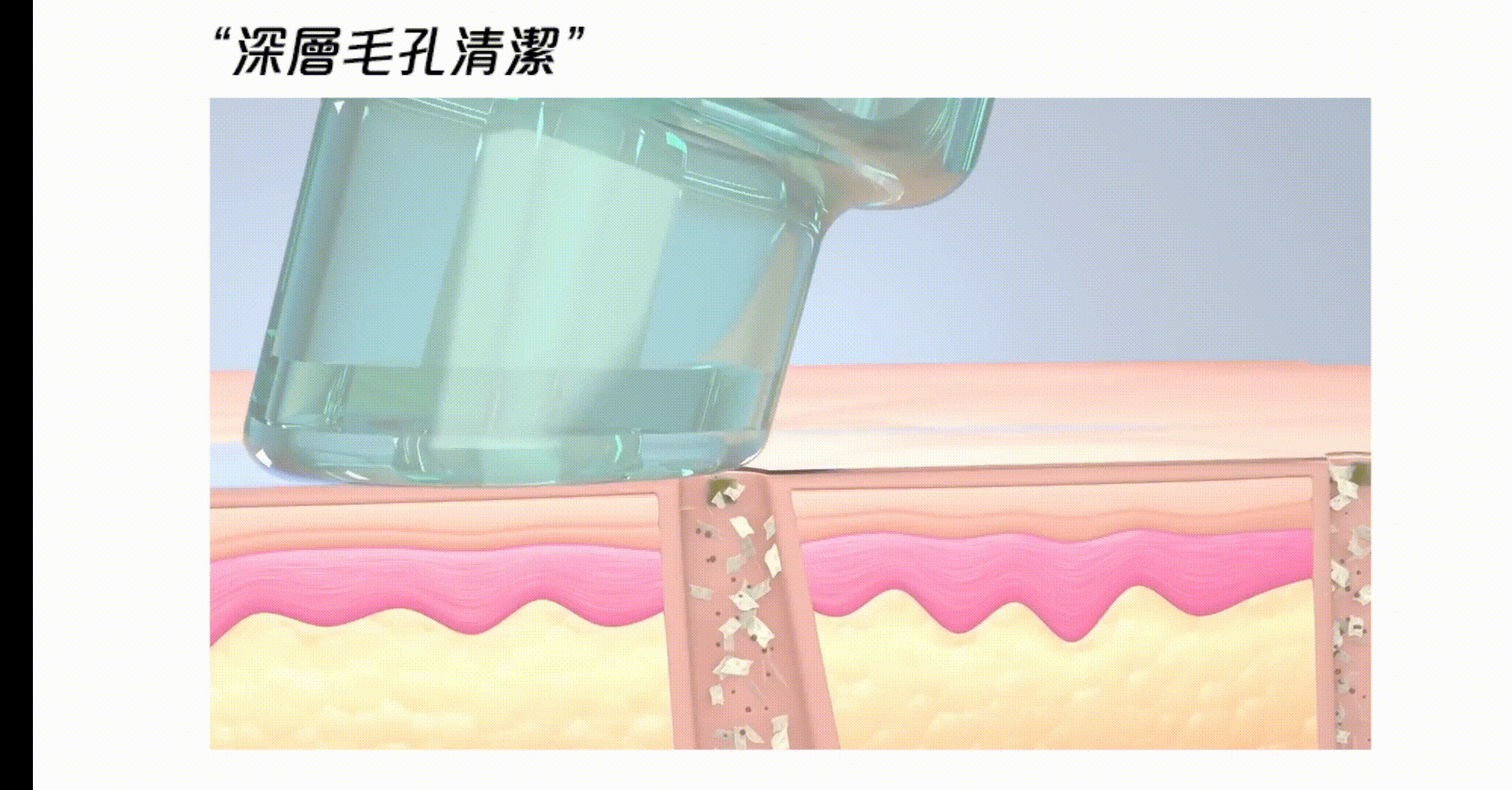 毛孔清道夫-清粉刺-海菲秀-粉刺-毛孔-中壢醫美-桃園醫美-林口醫美-桃園清粉刺-中壢清粉刺