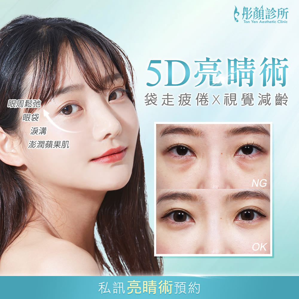 5D亮睛術-眼袋-眼袋手術-眼袋推薦-眼袋手術推薦-眼袋術前術後對比照-中壢醫美-桃園醫美