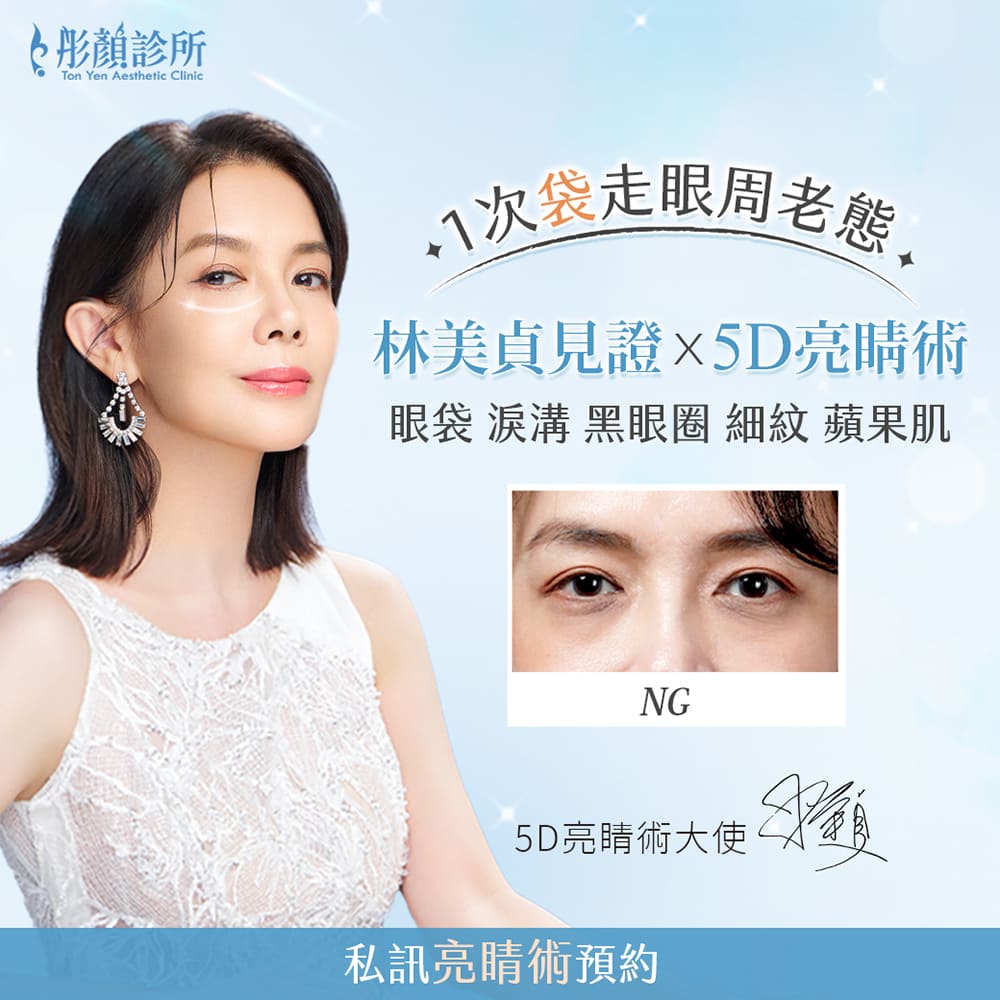 5D亮睛術-眼袋-眼袋手術-眼袋推薦-林美貞眼袋-眼袋手術推薦-眼袋術前術後對比照-中壢醫美-桃園醫美