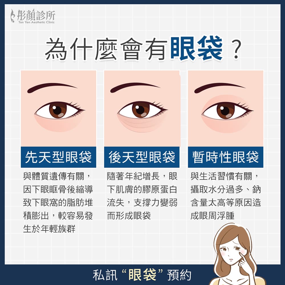 眼袋-5D亮睛術-眼袋手術-眼袋推薦-眼袋手術推薦-中壢醫美-桃園醫美