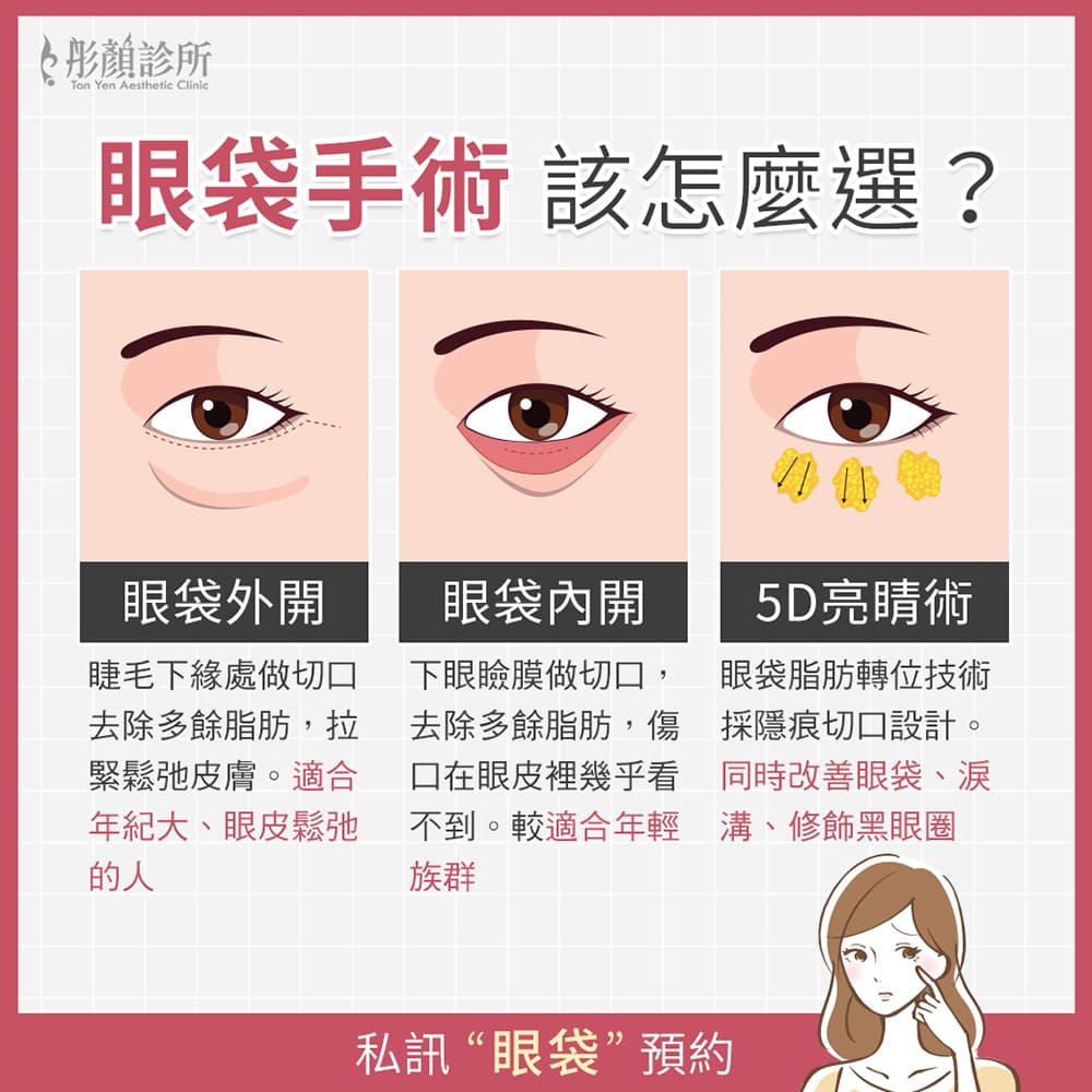 眼袋-5D亮睛術-眼袋手術-眼袋推薦-眼袋手術內開外開差異-眼袋手術推薦-中壢醫美-桃園醫美