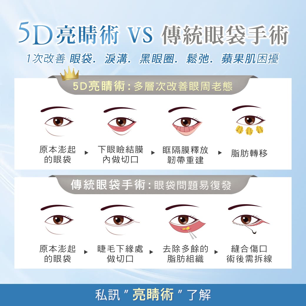 5D亮睛術-隱痕眼袋-眼袋手術-淚溝-黑眼圈-眼袋-中壢醫美-桃園醫美-眼袋手術費用-眼袋如何消除