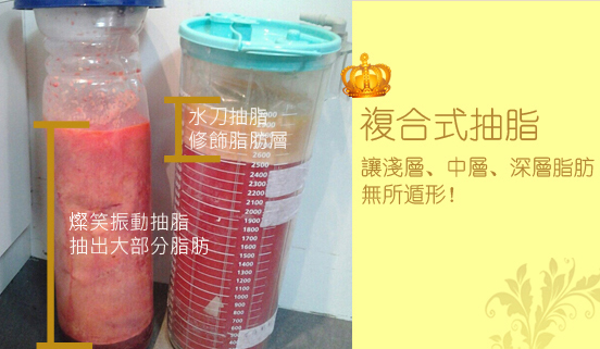 彤顏診所-複合式抽脂-抽脂-水刀抽脂-曲線雕塑-脂雕-體雕-瘦身-塑身