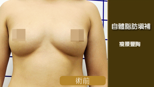 彤顏診所-自體脂肪隆乳-豐頰-自體脂肪補脂-豐胸-自體脂肪填補-全臉補脂-豐額頭-補脂