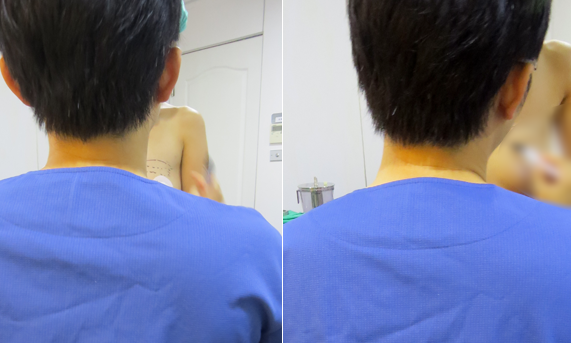 彤顏診所-自體脂肪隆乳-豐頰-自體脂肪補脂-豐胸費用-自體脂肪填補-全臉補脂-豐額頭