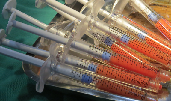 彤顏診所-自體脂肪隆乳-豐頰-自體脂肪補脂-豐胸-自體脂肪填補-全臉補脂-豐額頭-中壢整形外科