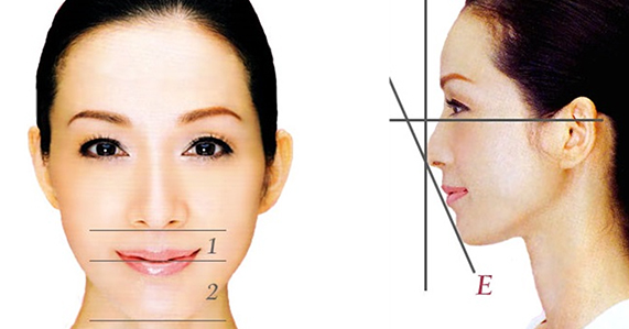 墊下巴-卡麥拉-下巴黃金比例-下巴後縮-下巴整形