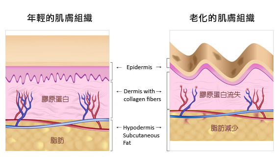 輪廓拉提-面部拉提-線雕拉提-中下臉拉提