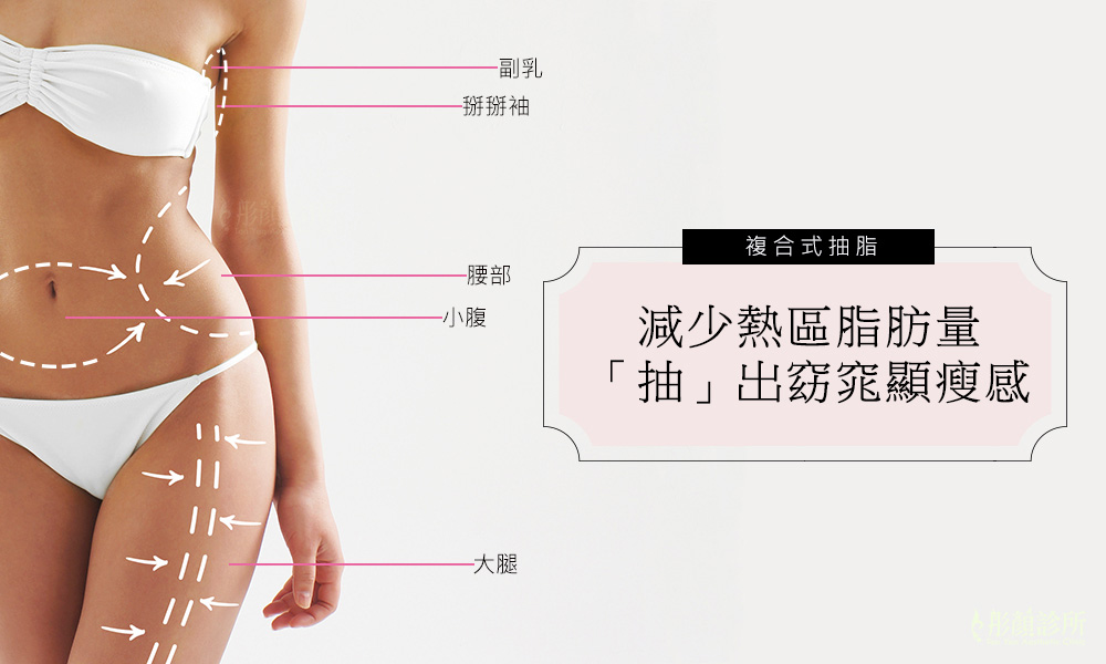彤顏診所-複合式抽脂-抽脂-抽脂部位-手臂抽脂-腰腹抽脂-抽脂手術-體雕-瘦身-大腿抽脂