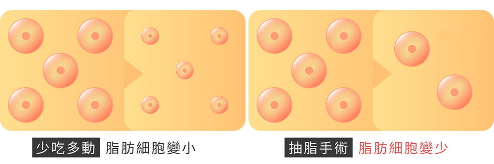 彤顏診所-抽脂-雷射燃脂-複合式抽脂-雷射溶脂-抽脂術後-節食減肥-超音波抽脂-抽脂費用-價格-手臂抽脂-掰掰肉-蝴蝶袖副乳-大腿抽脂-藝術體雕