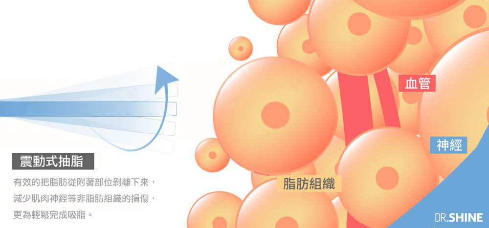 彤顏診所-複合式抽脂-抽脂-震動式抽脂-抽脂手術推薦-全身抽脂