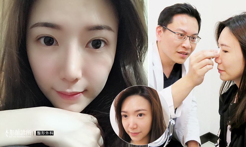 彤顏診所-隆鼻-黃金比例-立體結構式隆鼻-隆鼻價格-結構式隆鼻-隆鼻推薦-隆鼻手術-韓式隆鼻-卡麥拉隆鼻-整形外科-縮鼻翼-蒜頭鼻-桃園隆鼻-中壢隆鼻-隆鼻費用