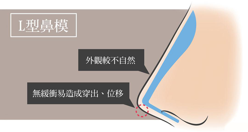 彤顏診所-隆鼻-黃金比例-立體結構式隆鼻-隆鼻價格-結構式隆鼻-隆鼻推薦-隆鼻手術-韓式隆鼻-卡麥拉隆鼻-整形外科-縮鼻翼-蒜頭鼻-桃園隆鼻-中壢隆鼻-隆鼻費用