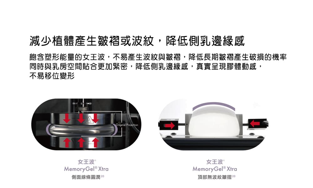 女王波-女王波手感-隆乳-女王波隆乳-隆乳手術-隆乳費用