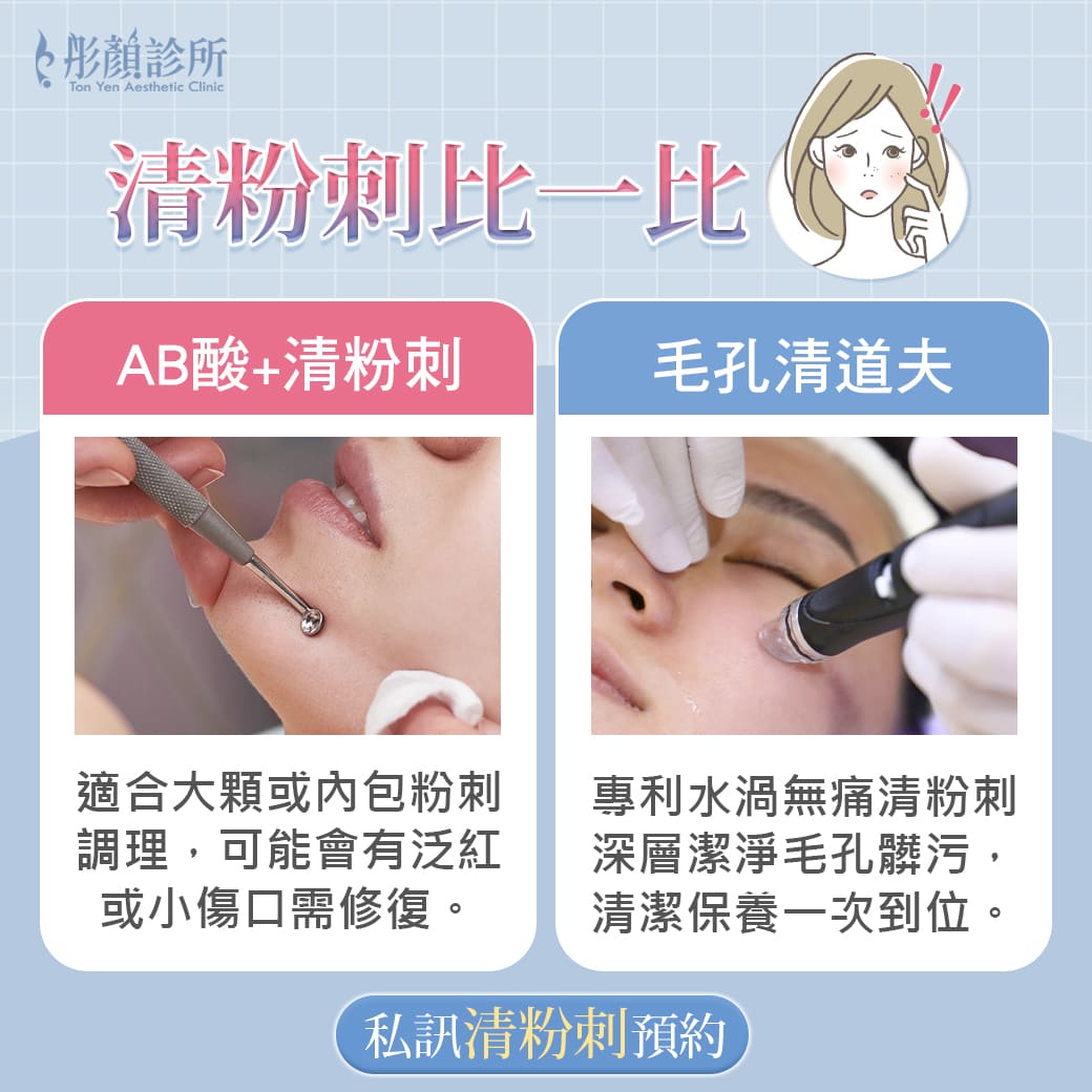 粉刺-無痛清粉刺-粉刺醫美-閉鎖性粉刺-黑頭粉刺-中壢清粉刺-桃園清粉刺-清粉刺推薦-毛孔清道夫-杏仁酸-ab酸