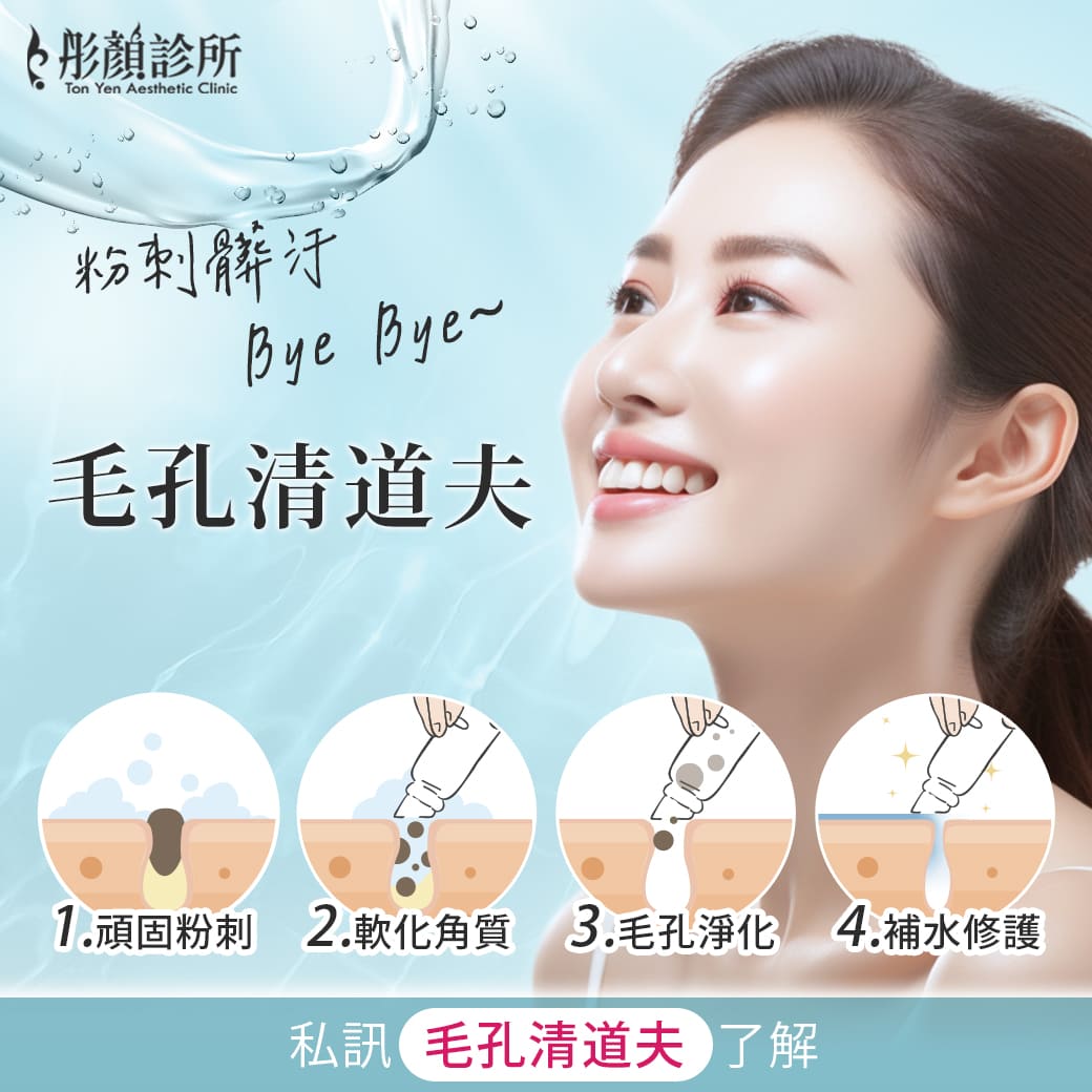 粉刺-無痛清粉刺-粉刺醫美-閉鎖性粉刺-黑頭粉刺-中壢清粉刺-桃園清粉刺-清粉刺推薦-毛孔清道夫-杏仁酸-ab酸