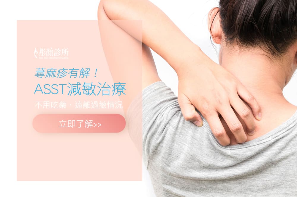 蕁麻疹-慢性蕁麻疹-減敏治療