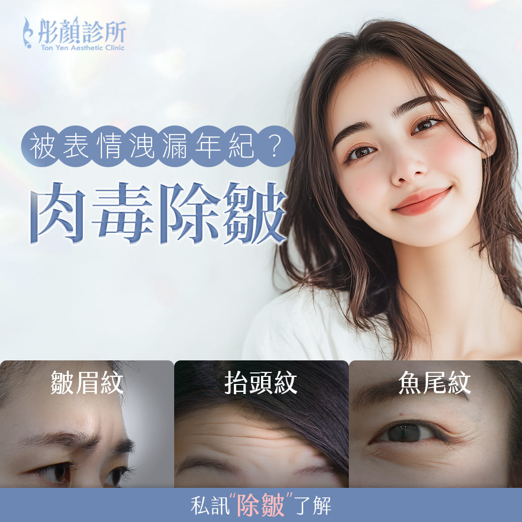 肉毒桿菌-肉毒除皺價格-瘦臉-肉毒桿菌醫美-瘦小腿-抬頭紋-魚尾紋-皺眉紋-肉毒-小臉-肉毒桿菌效果-小臉肉毒