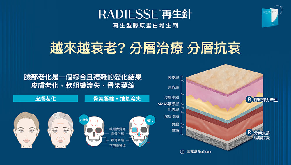 再生針-膠原蛋白增生劑-Radiesse-晶亮瓷-山根-臉型雕塑-法令紋-淚溝填補-隆鼻-墊下巴-蘋果肌-藝術面雕