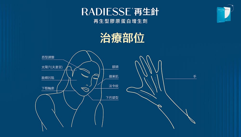 再生針治療部位-膠原蛋白增生劑-法令紋-淚溝填補-墊下巴-蘋果肌-藝術面雕