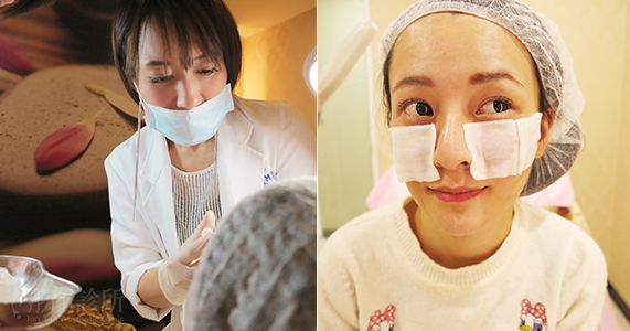 洢蓮絲效果-依戀詩效果-EllANSE-桃園醫美推薦