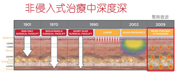 彤顏診所-雙波拉提-鳳凰電波拉提-音波拉提