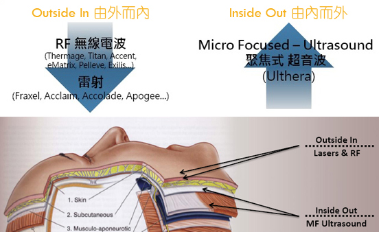 彤顏診所-音波拉皮-中壢音波拉提-桃園音波拉提-八德音波拉提-美國音波拉提-電音雙波