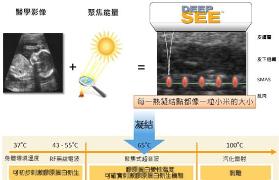 音波拉提-抗老拉提-中壢音波拉提-桃園音波拉提-八德音波拉提-美國音波拉提-電音雙波-美國音波效果