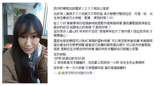 音波拉提-美國音波拉提-ulthera-極線音波拉提-音波拉提適合哪些人-美國音波效果