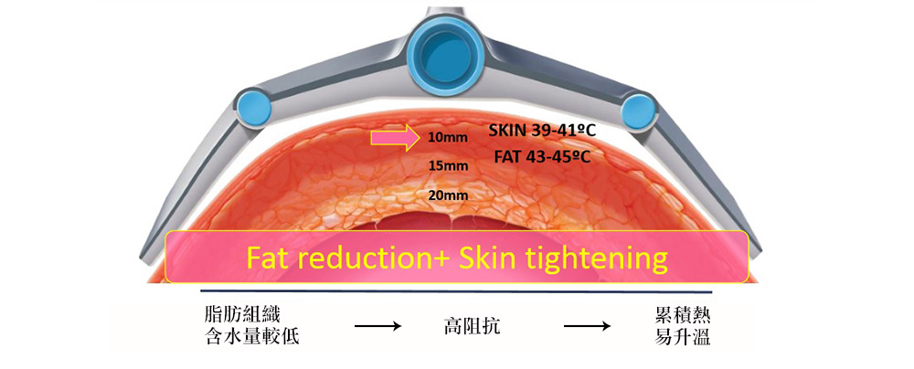 彤顏診所-減肥-減重-瘦身-隔空減脂-體外減脂-貴妃減脂-電波減脂-溶脂-vanquish-瘦大腿-瘦小腹-瘦腰