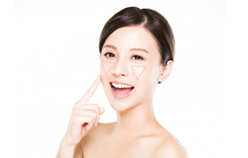 蘋果肌-法令紋-藝術面雕-彤顏診所-玻尿酸-依戀詩-童顏針-水微晶-晶亮瓷-二代童顏針-淚溝-夫妻宮-玻尿酸價格-玻尿酸費用