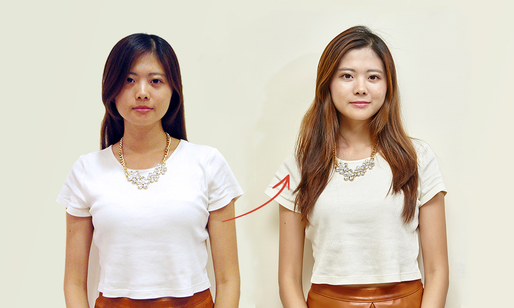 蘋果肌-法令紋-藝術面雕-彤顏診所-玻尿酸-依戀詩-童顏針-水微晶-晶亮瓷-二代童顏針-心型臉-微整形-淚溝-夫妻宮-玻尿酸價格-玻尿酸費用