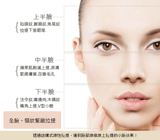 結構式線性拉提-線雕拉提-拉皮