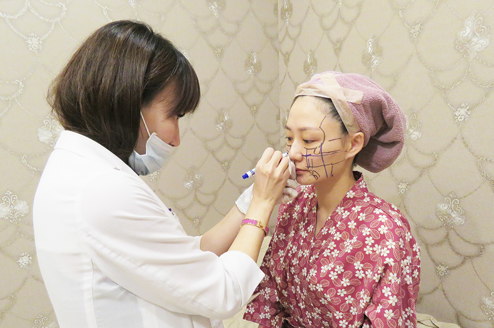 結構式線性拉提-線雕拉提-拉皮