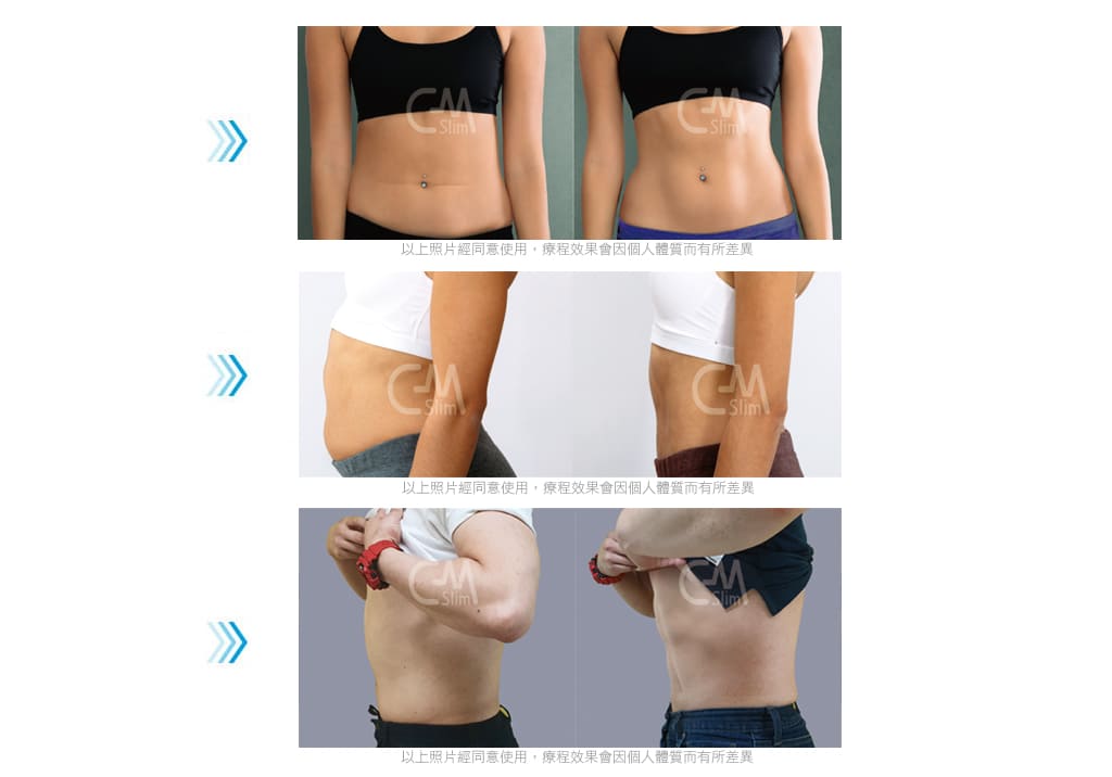 增肌減脂-CM SLIM-腹肌-增肌-馬甲線-腹肌訓練-川字肌-翹臀-減體脂肪-腹直肌-腹直肌分離-二代增肌減脂儀-快速瘦身-產後肥胖