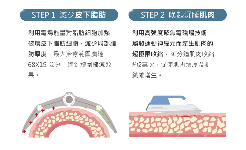增肌減脂四部曲-肌動減脂-embody-CM SLIM-隔空減脂-腹肌-瘦身-增肌-減脂-減少皮下脂肪-喚醒沉睡肌肉-彤顏診所-vanquish