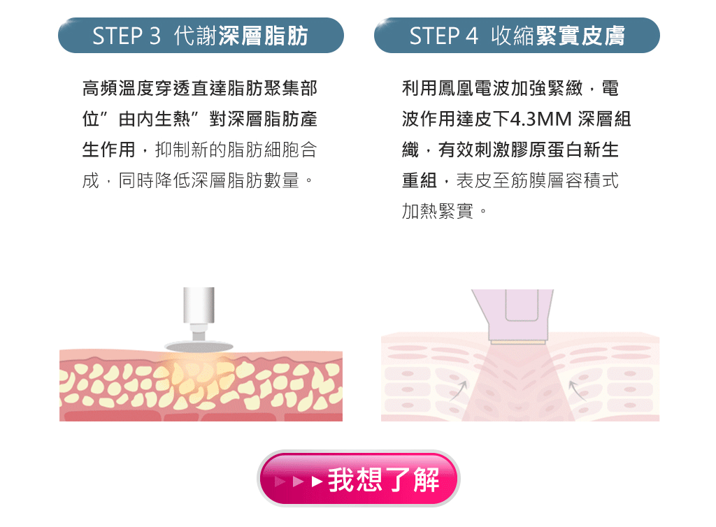 增肌減脂四部曲-肌動減脂-embody-CM SLIM-隔空減脂-鳳凰電波-黃金電波-腹肌-瘦身-增肌-減脂-代謝深層脂肪-腹直肌分離-妊娠紋-彤顏診所-收縮緊實皮膚