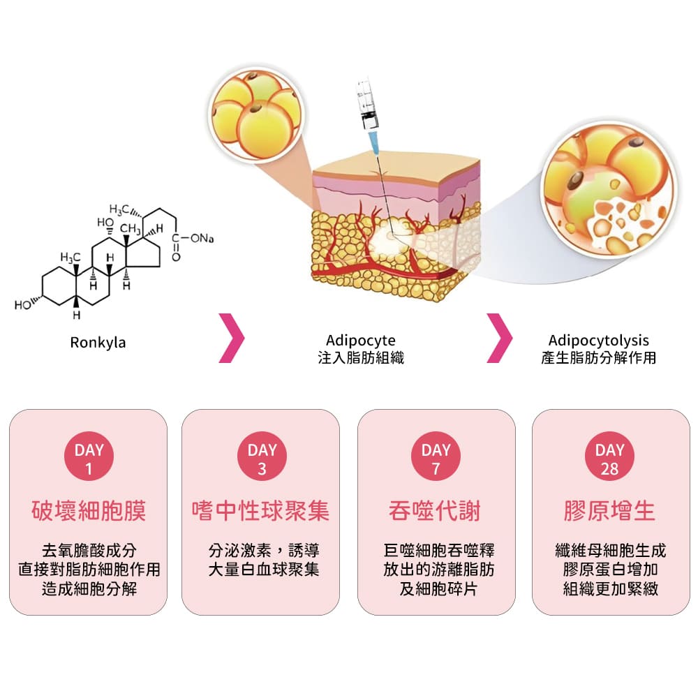 容脂針-消脂針-雙下巴-ronkyla-容脂針效果-醫美-容脂注射-消脂針效果