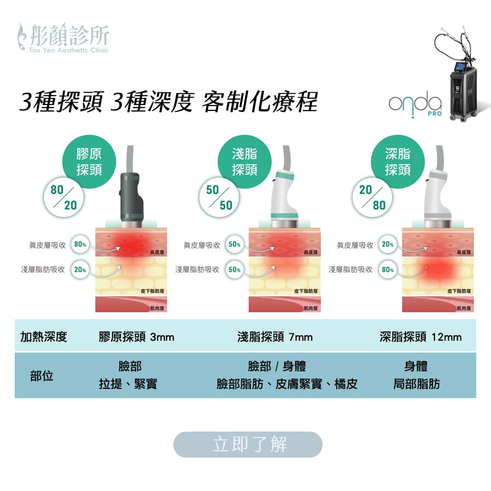 onda-onda pro-昂達超微波-雙下巴-onda減脂-onda 醫美-onda效果-桃園醫美-永和醫美